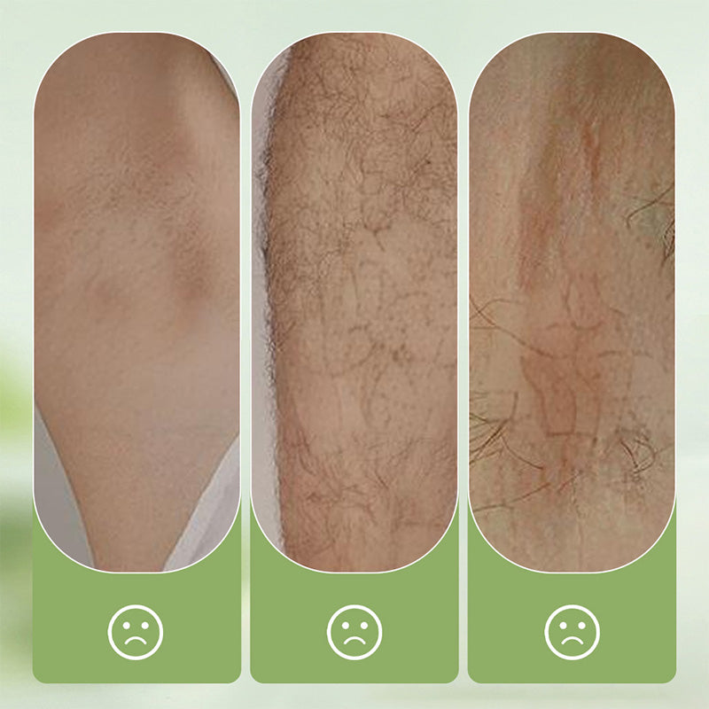Skånsom elektrisk hårfjerner