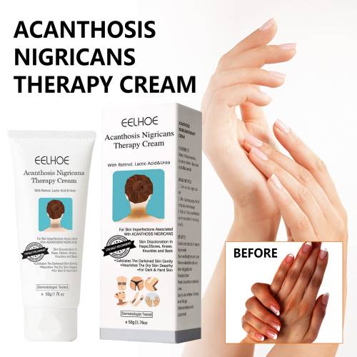 Retinol og niacinamid bodycreme til mørke områder