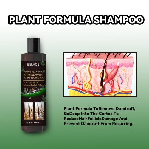 Urte hovedbundsshampoo med bynke og kaprifolie