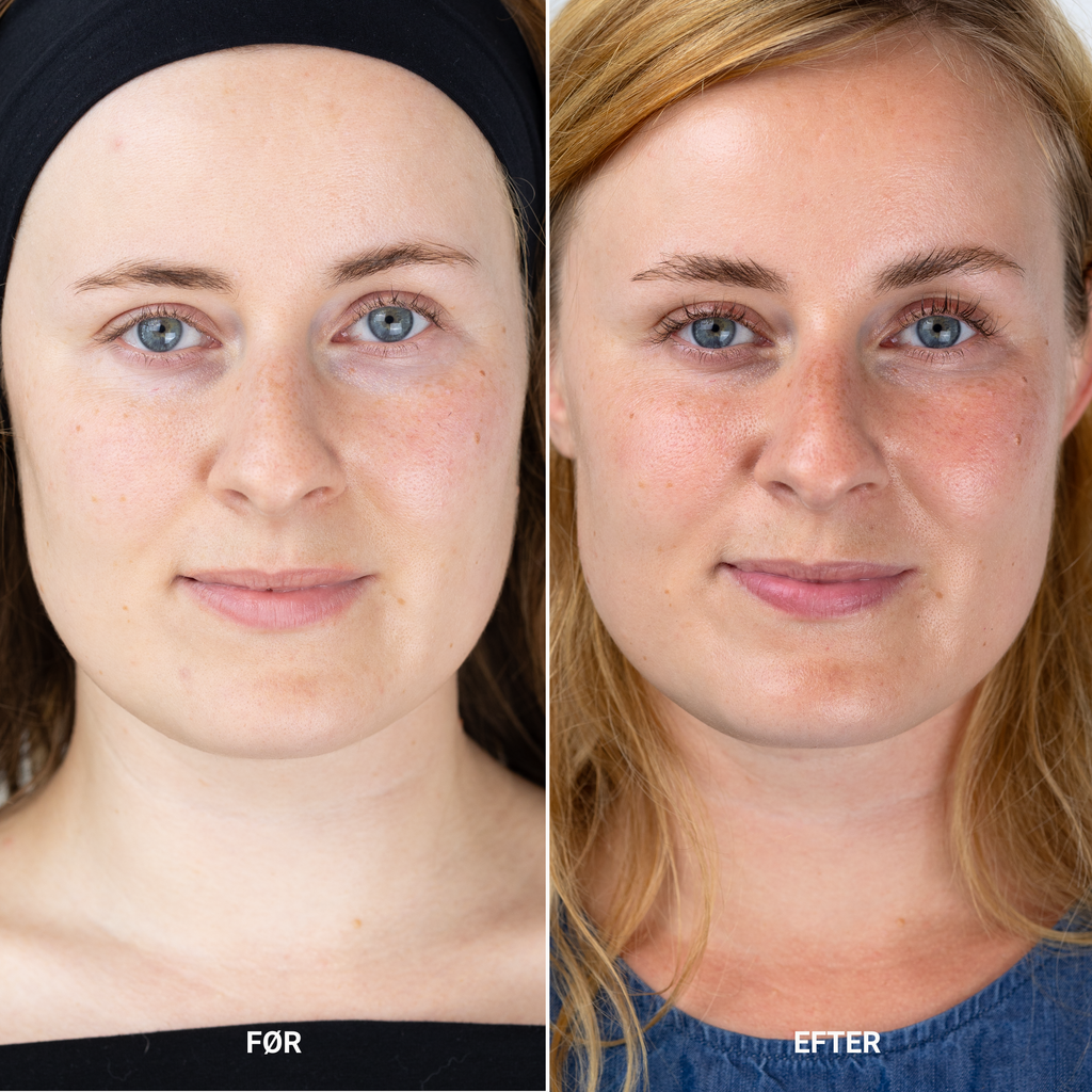 ANTI-AGING FACE CREAM