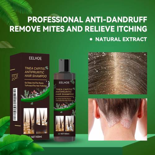 Urte hovedbundsshampoo med bynke og kaprifolie