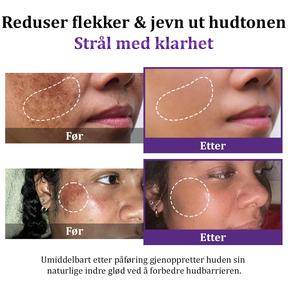 Et hurtigt fix til pletter og ujævn tone