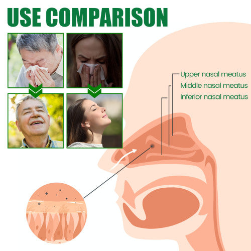 Quercetin næsespray