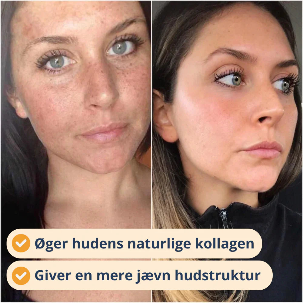 LED Lysterapi Maske