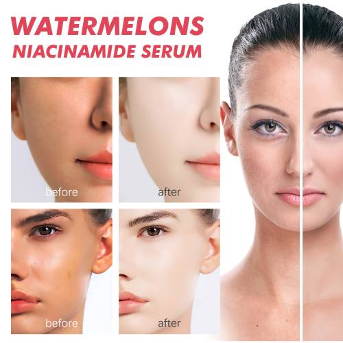 Vandmelon niacinamid serum