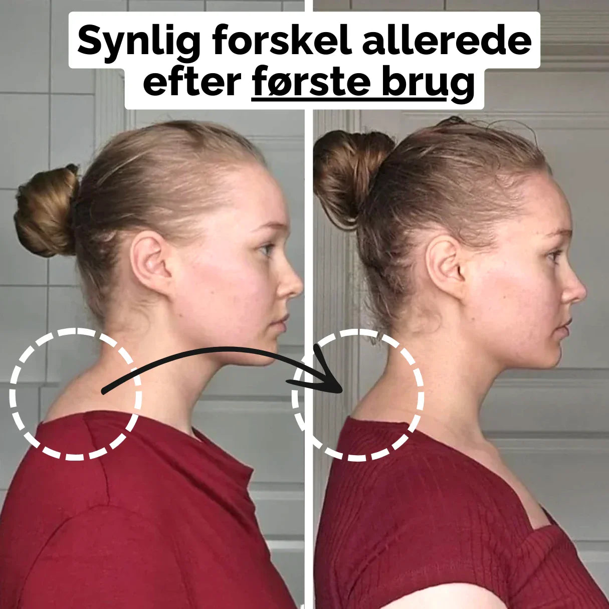 ACUFlex - Nakkestrækker med akupressur