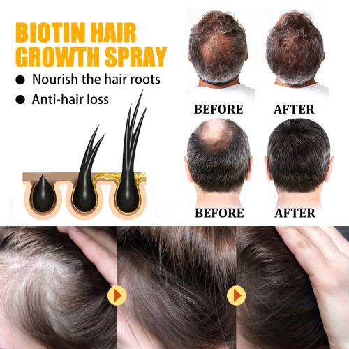 Biotin hårspray
