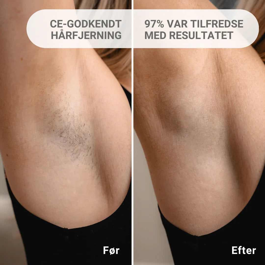 2x IPL Permanent hårfjerner Pakketilbud