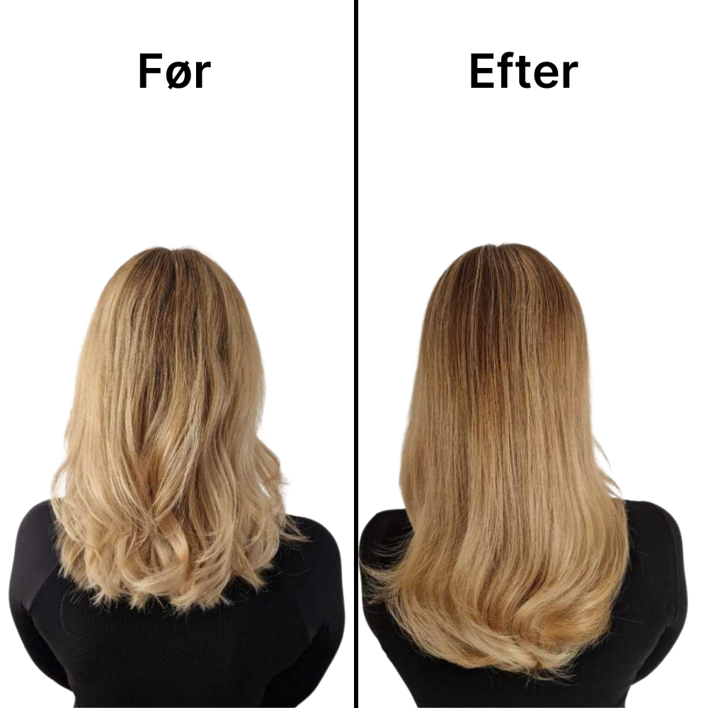 RelaxScalp Pro – Ultimativ Afslapning & Effektiv Hårpleje for Tykere, Sundere Hår