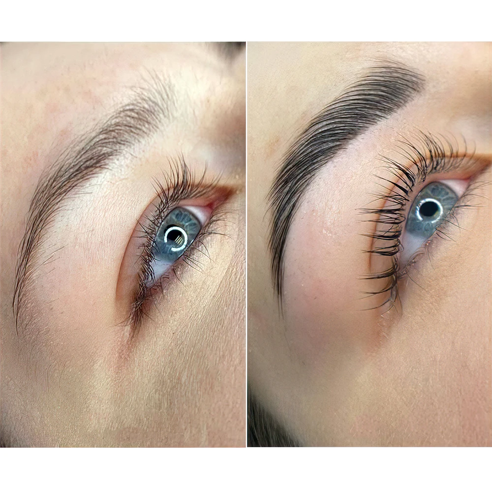 Brow Megapack