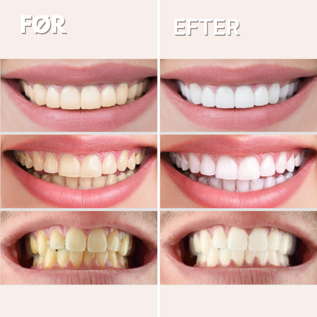 GlorySmile™ V34 Blegende Tandpasta (30 ml)
