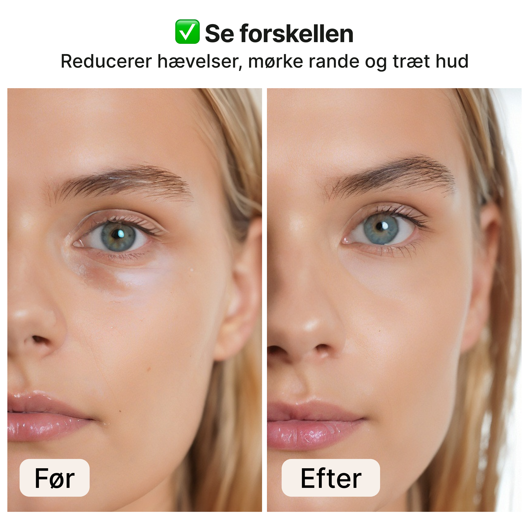 Mikrostrøm – Ansigtsmassageapparat