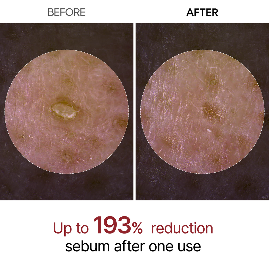 Peel Shot Glow – En lysende ansigtsserie med risekstrakter