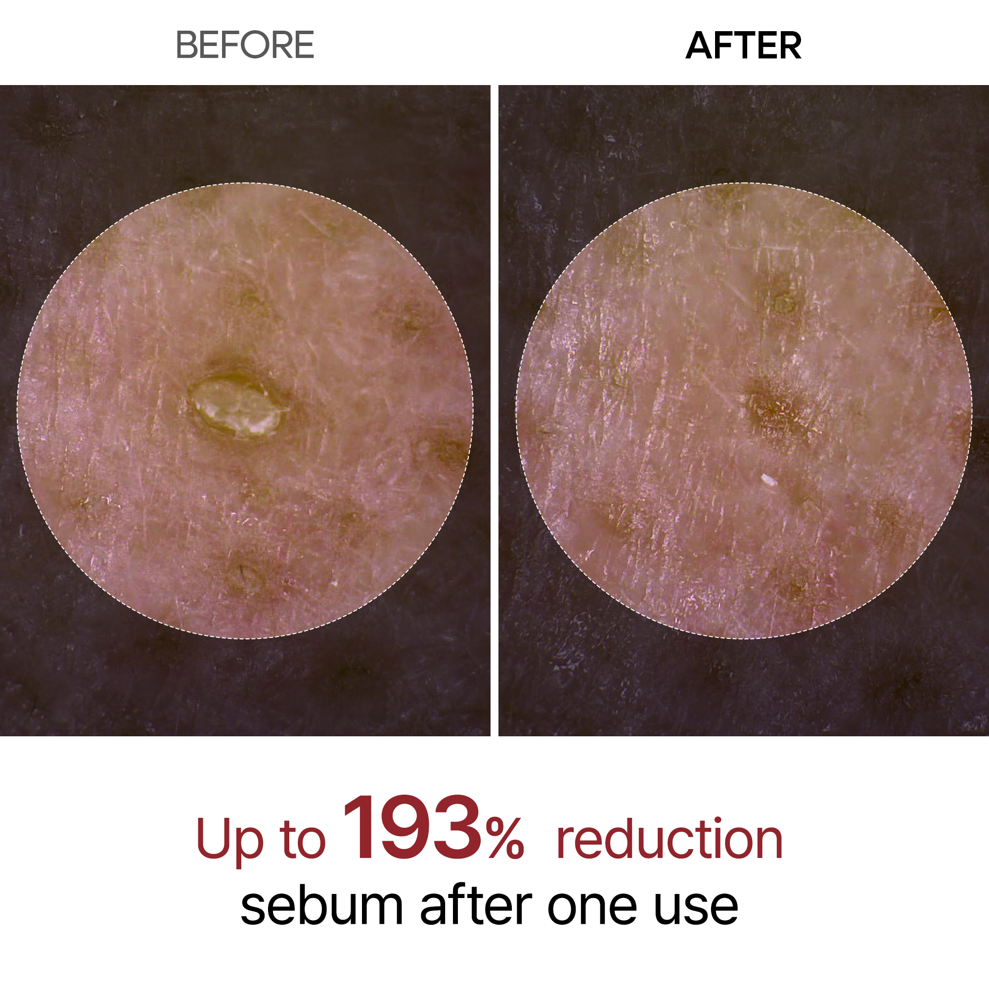 Peel Shot Glow – En lysende ansigtsserie med risekstrakter