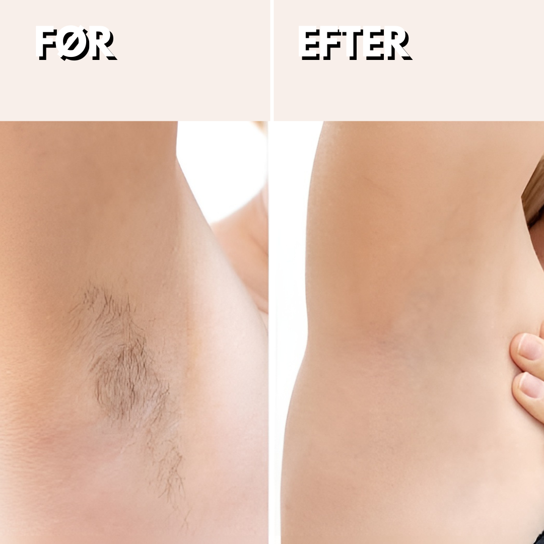 SilkTouch™ Barbermaskine - Let Præcision for et Fejlfrit Udseende