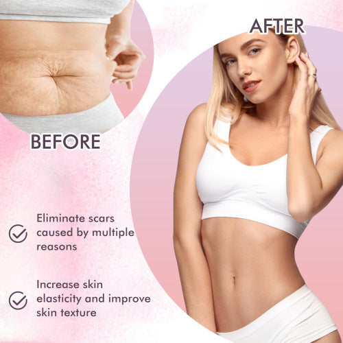 Retinol E-vitamin kropsolie