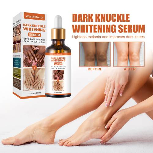 Serum til knæ, albuer og ankler, 50 g