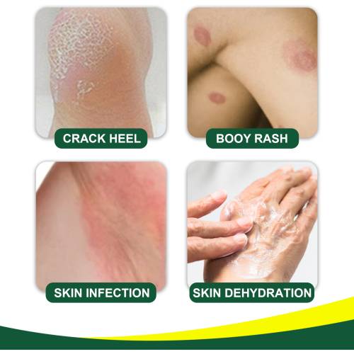 Aloe honning avocado hudcreme