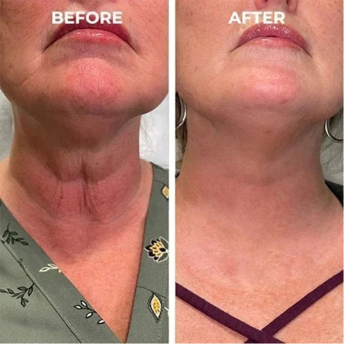 Peptid essenslotion med B5 og hyaluronsyre