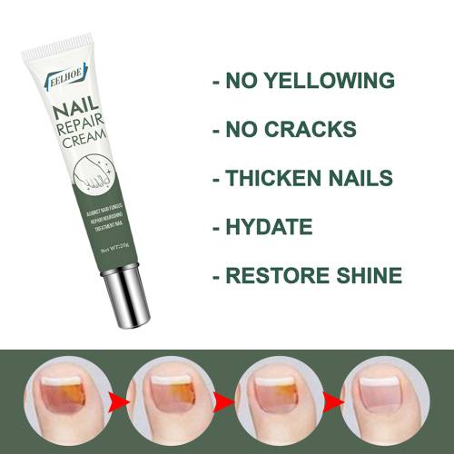 Plantebaseret neglecreme