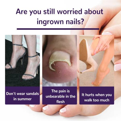 Elastiske strips til korrektion af tånegle