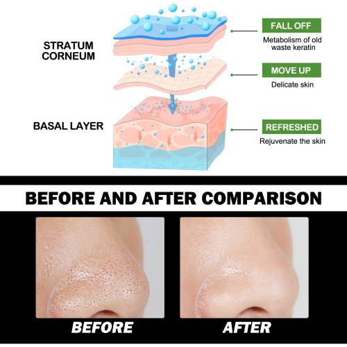 Bambuskul peel-off maske mod hudorme