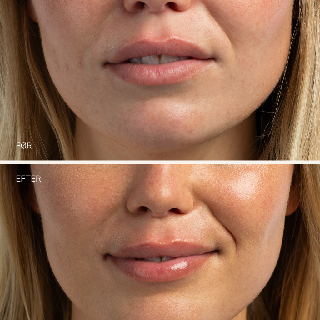 LIP BALM HYDRATING