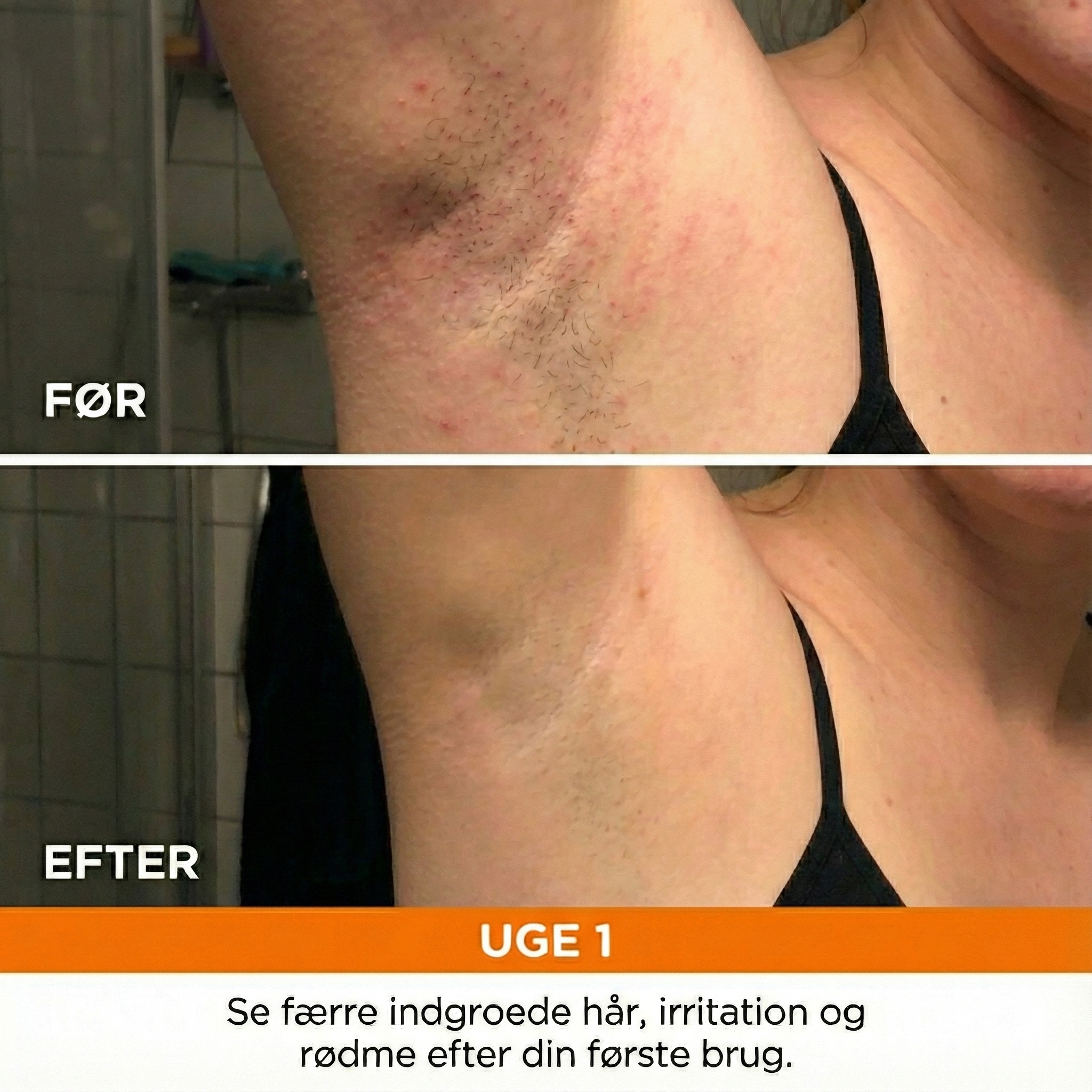 IPL Anti-hårvækst Serum
